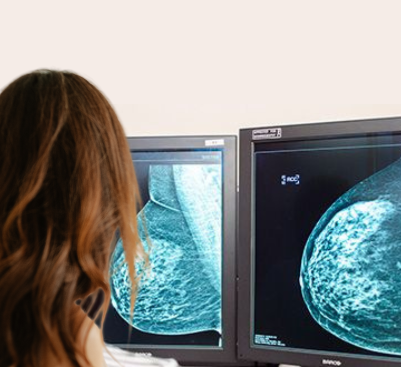 Breastscreen Victoria screening